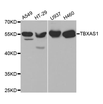 Western blot - TBXAS1 Antibody from Signalway Antibody (32539) - Antibodies.com