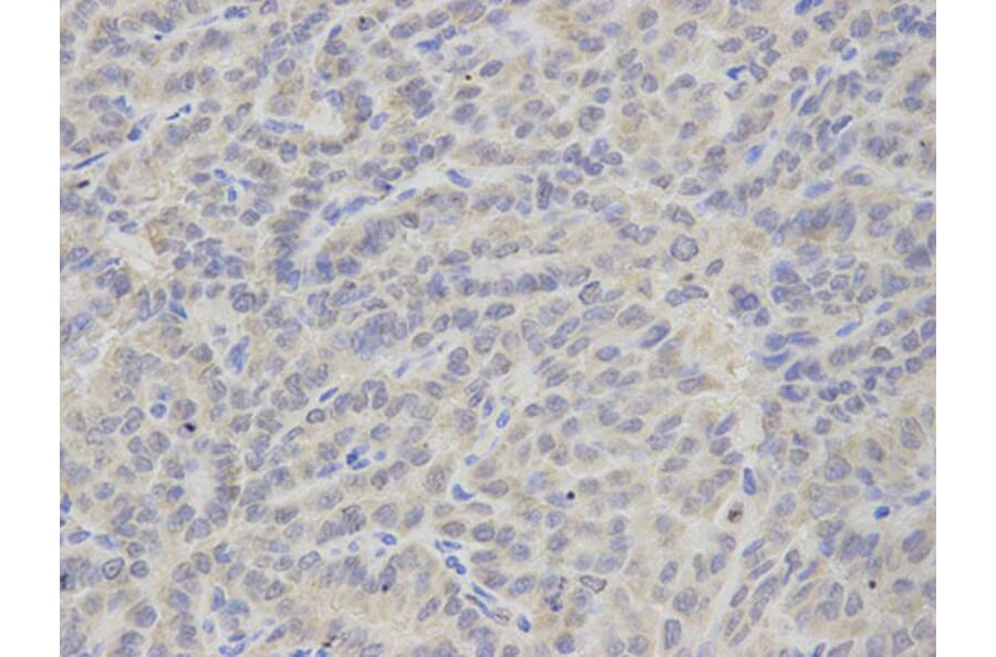 Immunohistochemistry - TBXAS1 Antibody from Signalway Antibody (32539) - Antibodies.com