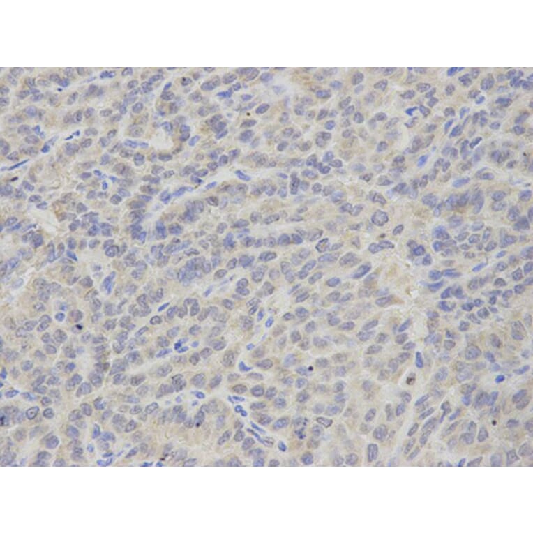 Immunohistochemistry - TBXAS1 Antibody from Signalway Antibody (32539) - Antibodies.com