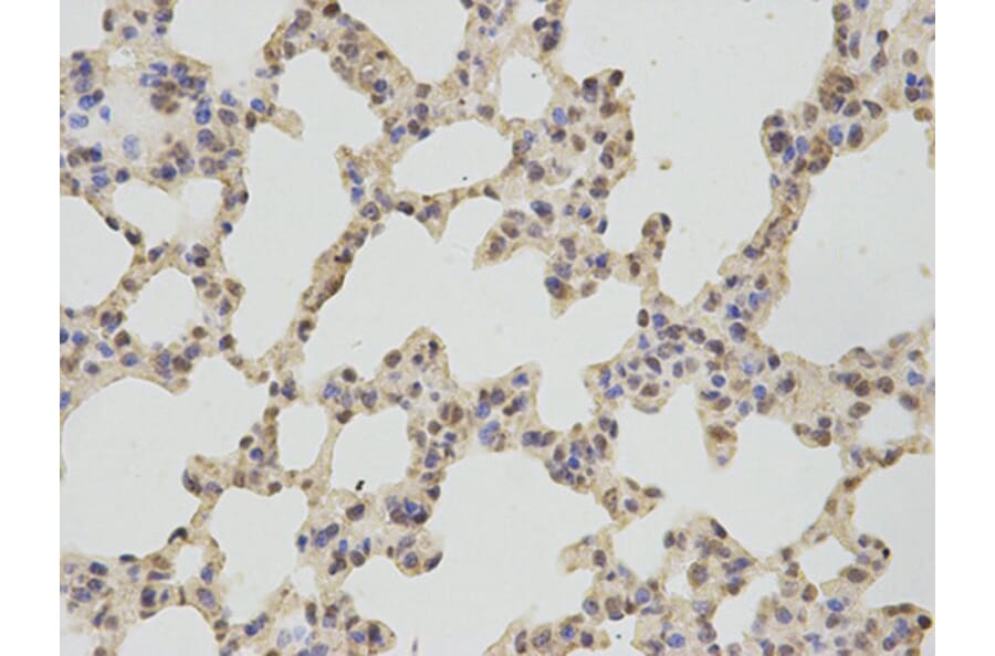 Immunohistochemistry - TBXAS1 Antibody from Signalway Antibody (32539) - Antibodies.com