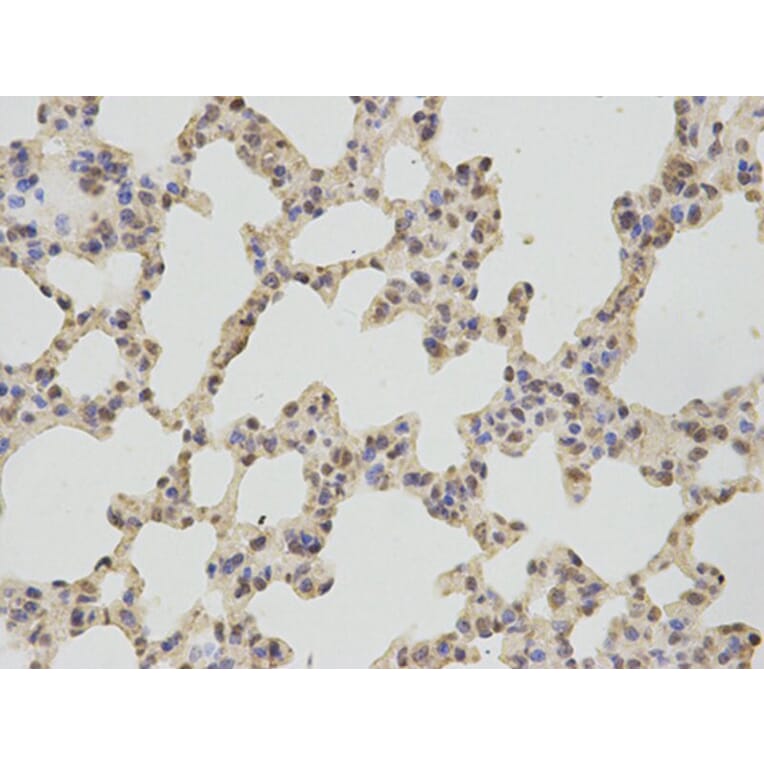 Immunohistochemistry - TBXAS1 Antibody from Signalway Antibody (32539) - Antibodies.com