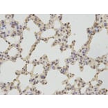 Immunohistochemistry - TBXAS1 Antibody from Signalway Antibody (32539) - Antibodies.com