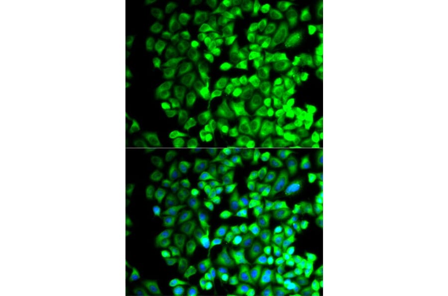 Immunofluorescence - TBXAS1 Antibody from Signalway Antibody (32539) - Antibodies.com