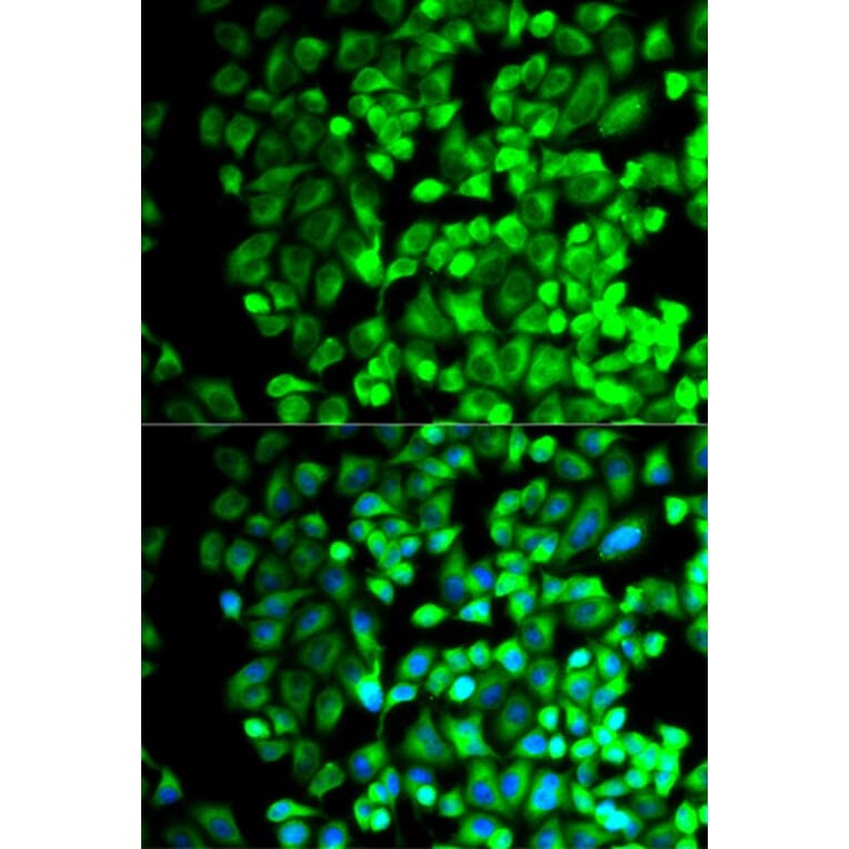Immunofluorescence - TBXAS1 Antibody from Signalway Antibody (32539) - Antibodies.com