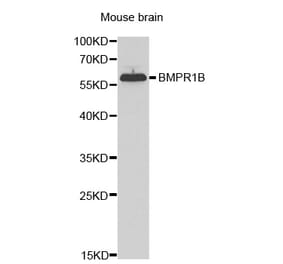 Western blot - BMPR1B Antibody from Signalway Antibody (32547) - Antibodies.com