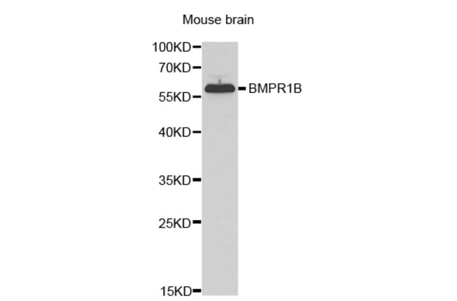 Western blot - BMPR1B Antibody from Signalway Antibody (32547) - Antibodies.com