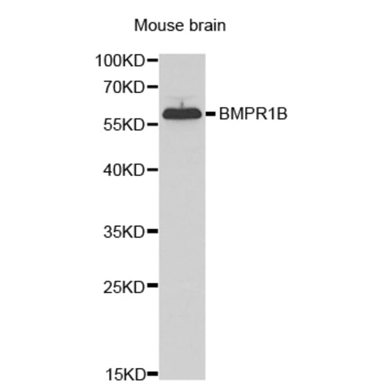 Western blot - BMPR1B Antibody from Signalway Antibody (32547) - Antibodies.com