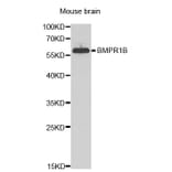 Western blot - BMPR1B Antibody from Signalway Antibody (32547) - Antibodies.com