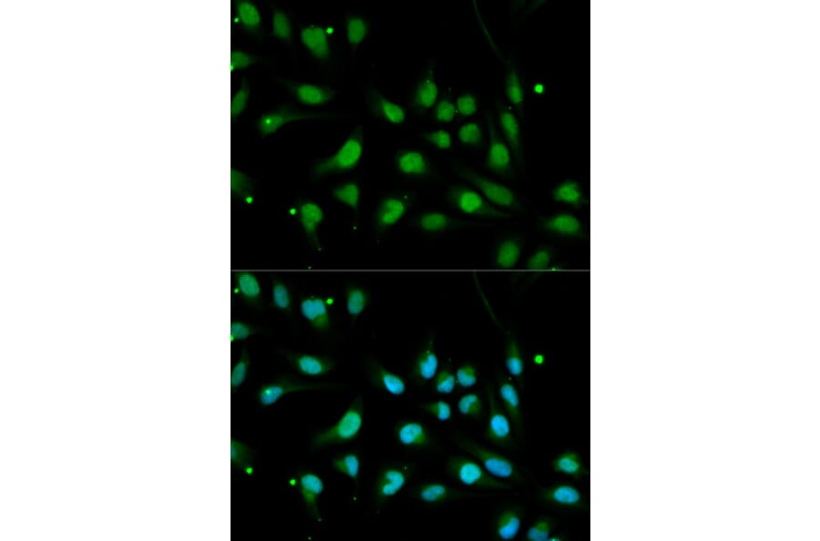 Immunofluorescence - BMPR1B Antibody from Signalway Antibody (32547) - Antibodies.com
