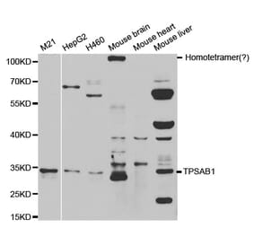 Western blot - TPSAB1 Antibody from Signalway Antibody (32555) - Antibodies.com