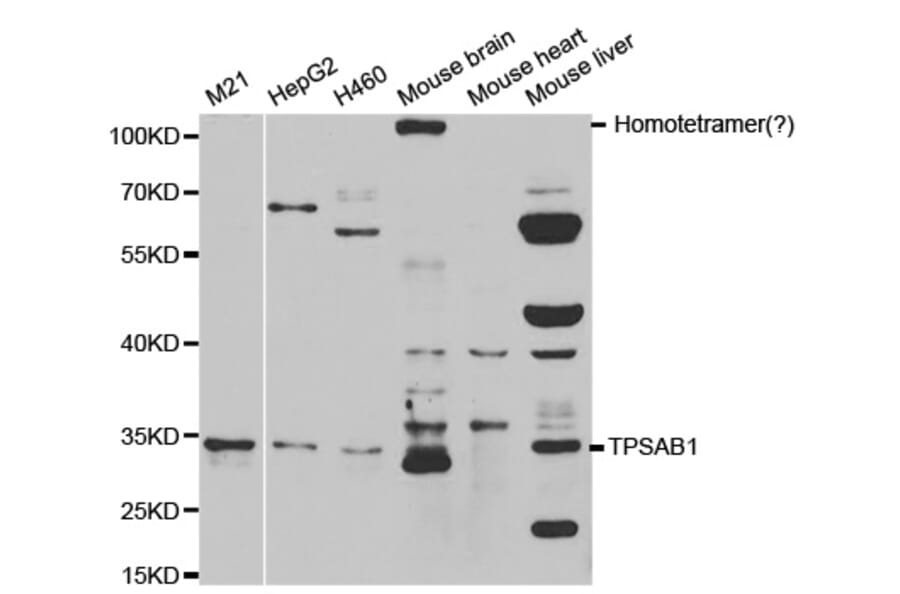 Western blot - TPSAB1 Antibody from Signalway Antibody (32555) - Antibodies.com