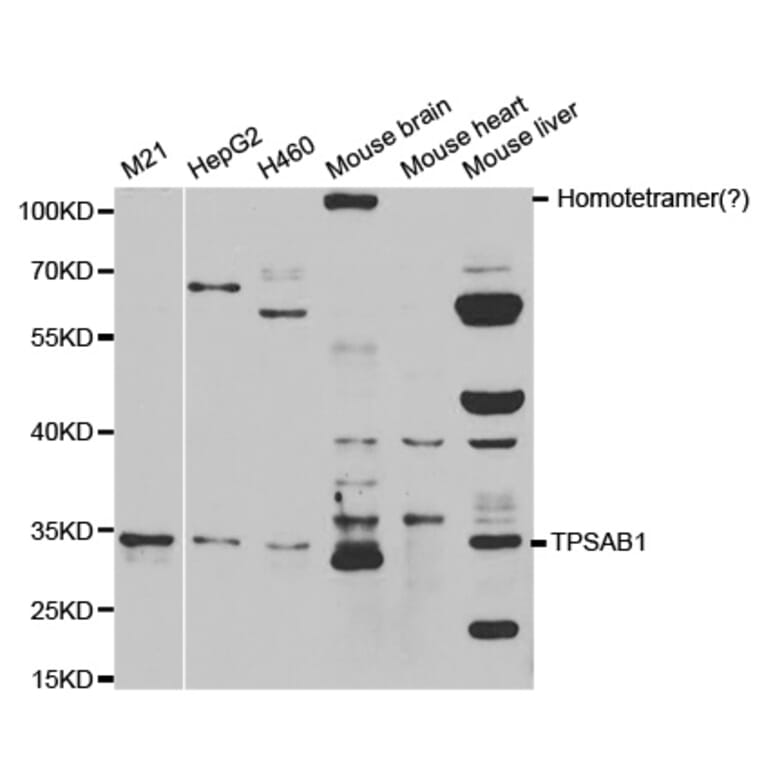 Western blot - TPSAB1 Antibody from Signalway Antibody (32555) - Antibodies.com