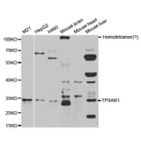 Western blot - TPSAB1 Antibody from Signalway Antibody (32555) - Antibodies.com