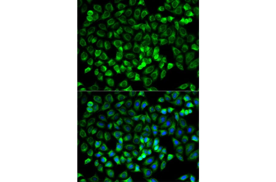 Immunofluorescence - TPSAB1 Antibody from Signalway Antibody (32555) - Antibodies.com