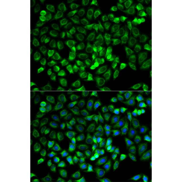 Immunofluorescence - TPSAB1 Antibody from Signalway Antibody (32555) - Antibodies.com