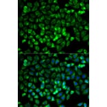 Immunofluorescence - TPSAB1 Antibody from Signalway Antibody (32555) - Antibodies.com