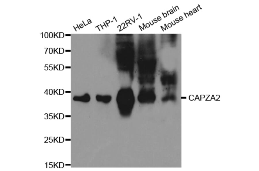 Western blot - CAPZA2 Antibody from Signalway Antibody (32573) - Antibodies.com
