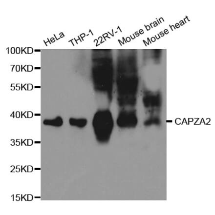 Western blot - CAPZA2 Antibody from Signalway Antibody (32573) - Antibodies.com