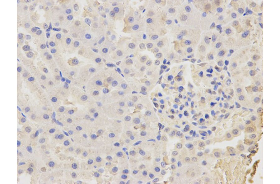 Immunohistochemistry - CAPZA2 Antibody from Signalway Antibody (32573) - Antibodies.com