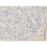 Immunohistochemistry - CAPZA2 Antibody from Signalway Antibody (32573) - Antibodies.com