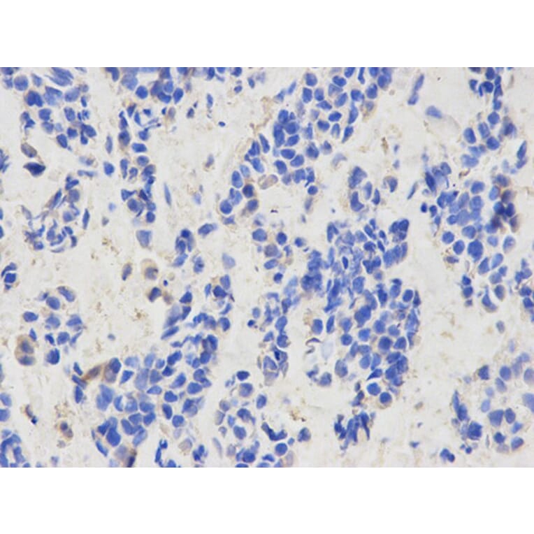 Immunohistochemistry - CAPZA2 Antibody from Signalway Antibody (32573) - Antibodies.com