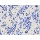 Immunohistochemistry - CAPZA2 Antibody from Signalway Antibody (32573) - Antibodies.com