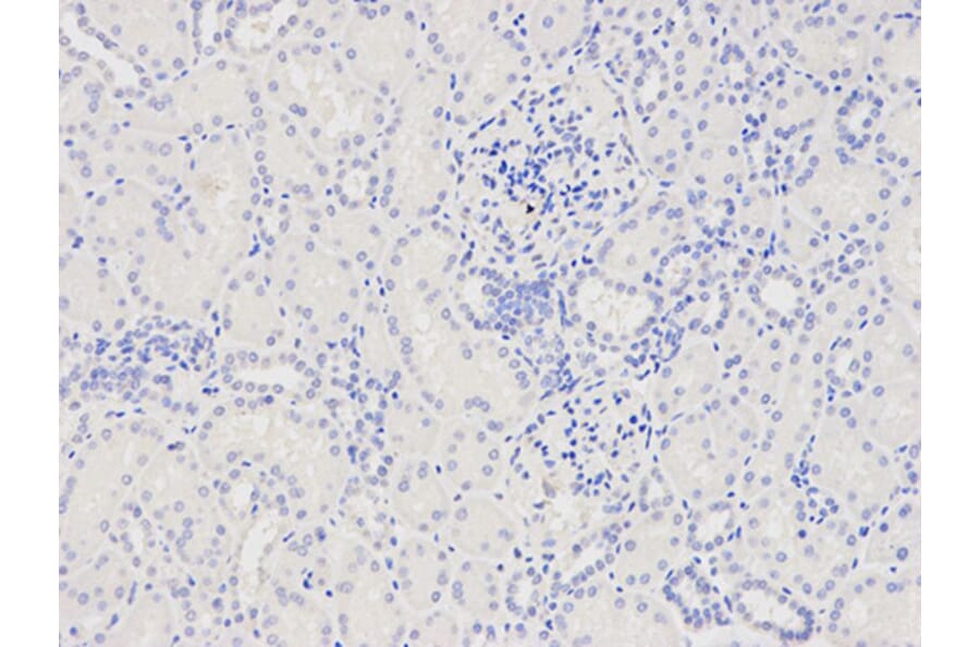 Immunohistochemistry - CAPZA2 Antibody from Signalway Antibody (32573) - Antibodies.com