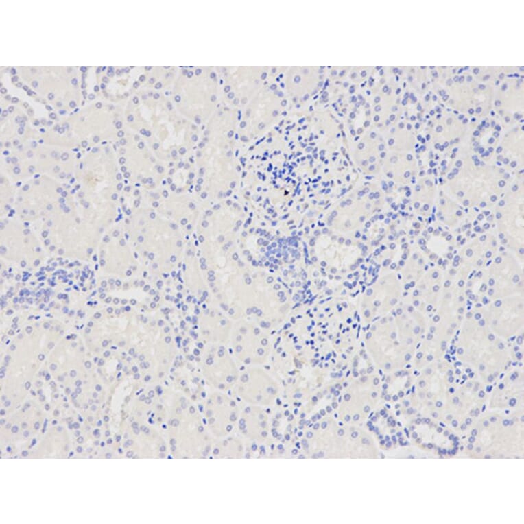 Immunohistochemistry - CAPZA2 Antibody from Signalway Antibody (32573) - Antibodies.com