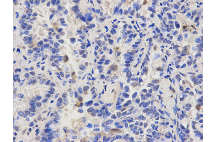 Immunohistochemistry - CAPZA2 Antibody from Signalway Antibody (32573) - Antibodies.com
