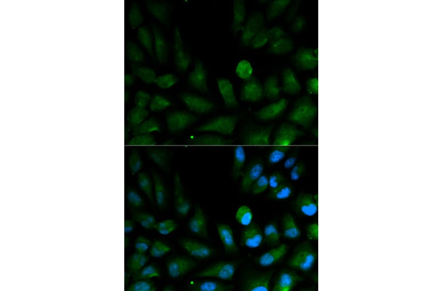 Immunofluorescence - CAPZA2 Antibody from Signalway Antibody (32573) - Antibodies.com
