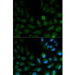 Immunofluorescence - CAPZA2 Antibody from Signalway Antibody (32573) - Antibodies.com