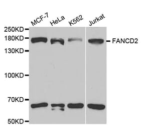 Western blot - FANCD2 Antibody from Signalway Antibody (32584) - Antibodies.com