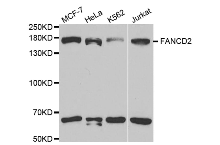 Western blot - FANCD2 Antibody from Signalway Antibody (32584) - Antibodies.com