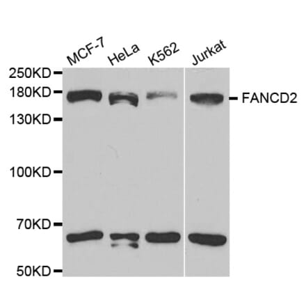 Western blot - FANCD2 Antibody from Signalway Antibody (32584) - Antibodies.com