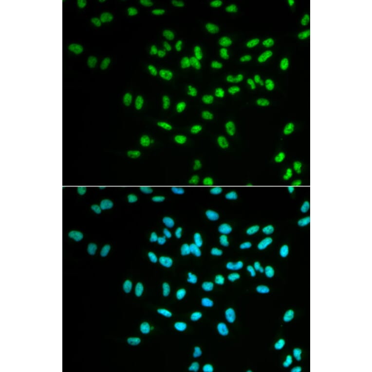Immunofluorescence - FANCD2 Antibody from Signalway Antibody (32584) - Antibodies.com