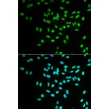 Immunofluorescence - FANCD2 Antibody from Signalway Antibody (32584) - Antibodies.com