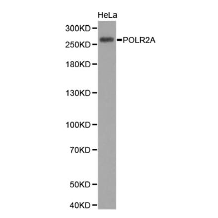 Western blot - POLR2A Antibody from Signalway Antibody (32600) - Antibodies.com
