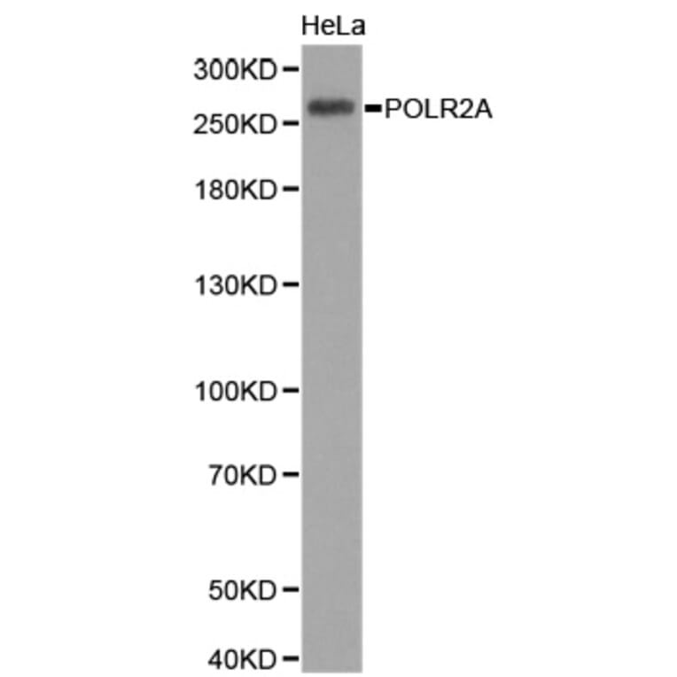 Western blot - POLR2A Antibody from Signalway Antibody (32600) - Antibodies.com
