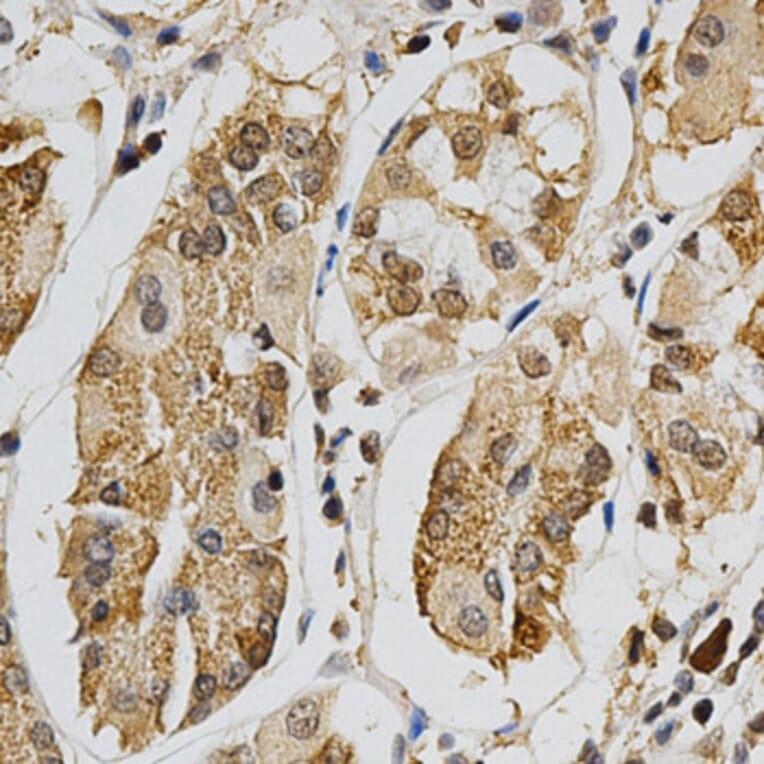 Immunohistochemistry - MAPK10 Antibody from Signalway Antibody (32605) - Antibodies.com