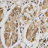 Immunohistochemistry - MAPK10 Antibody from Signalway Antibody (32605) - Antibodies.com