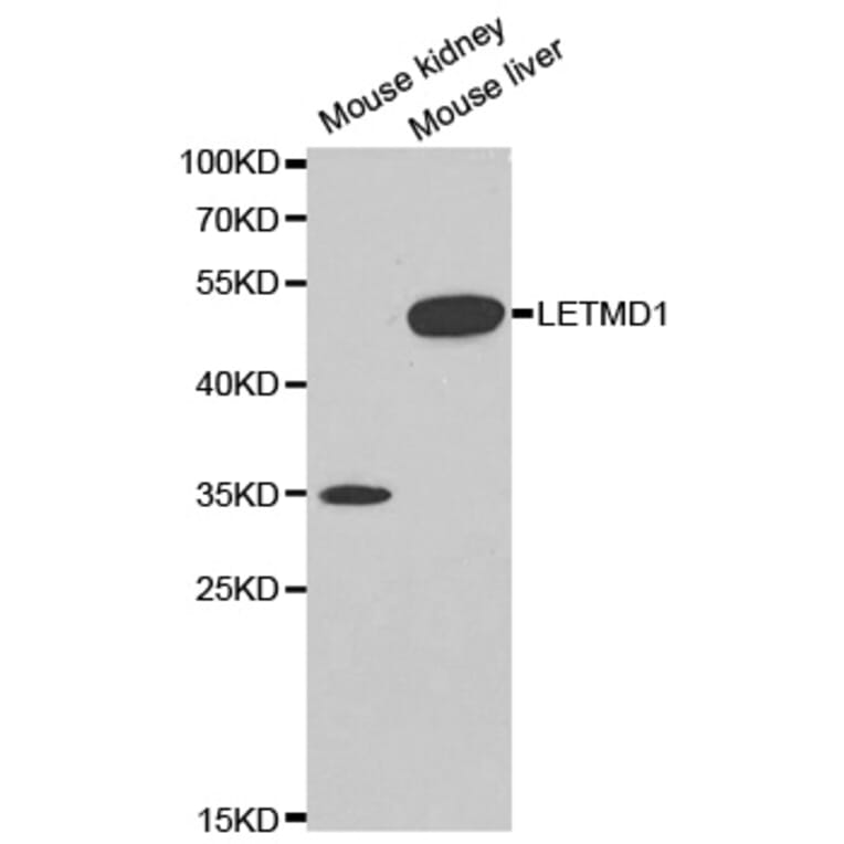 Western blot - LETMD1 Antibody from Signalway Antibody (32624) - Antibodies.com