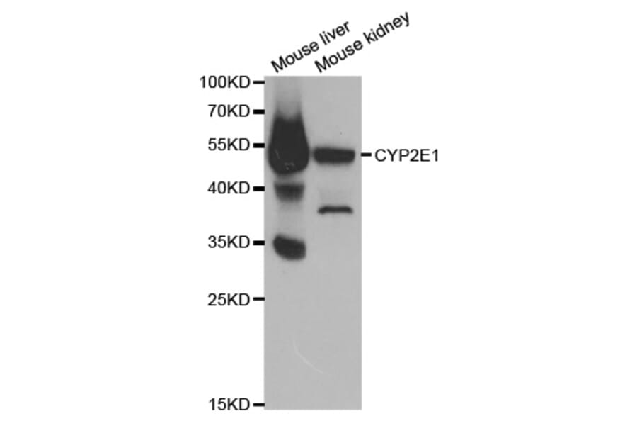 Western blot - CYP2E1 Antibody from Signalway Antibody (32630) - Antibodies.com
