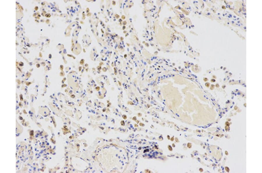 Immunohistochemistry - CYP2E1 Antibody from Signalway Antibody (32630) - Antibodies.com
