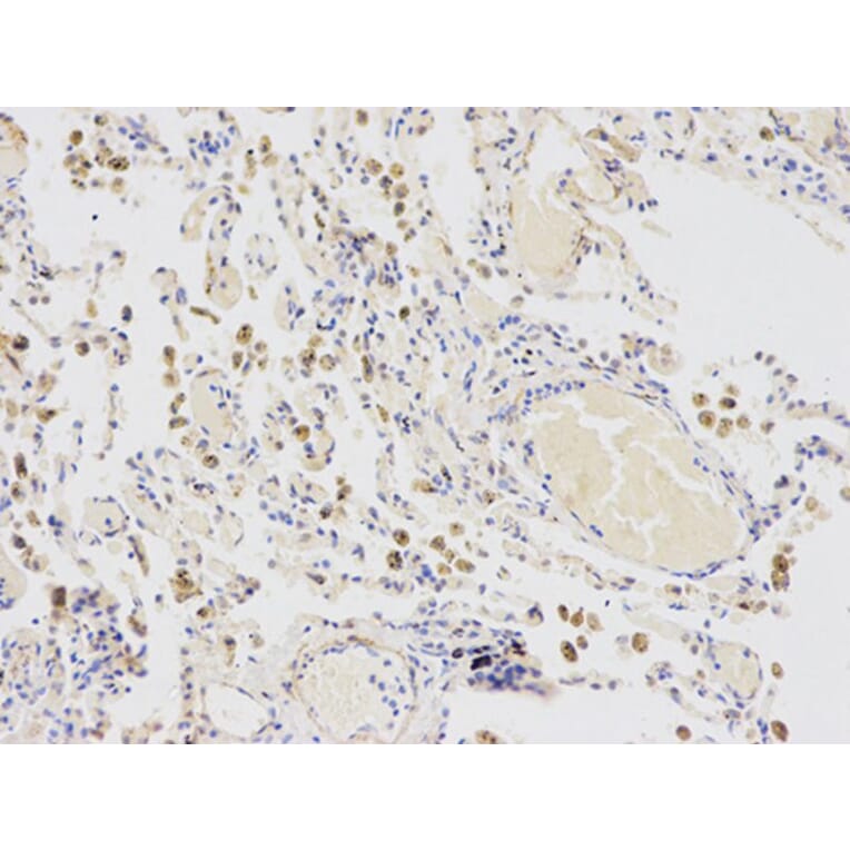 Immunohistochemistry - CYP2E1 Antibody from Signalway Antibody (32630) - Antibodies.com