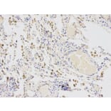 Immunohistochemistry - CYP2E1 Antibody from Signalway Antibody (32630) - Antibodies.com