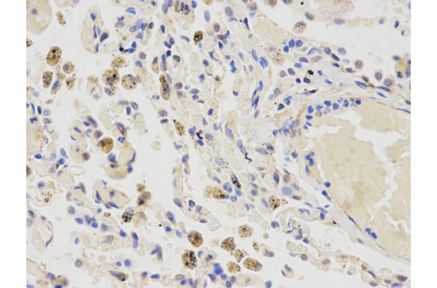 Immunohistochemistry - CYP2E1 Antibody from Signalway Antibody (32630) - Antibodies.com