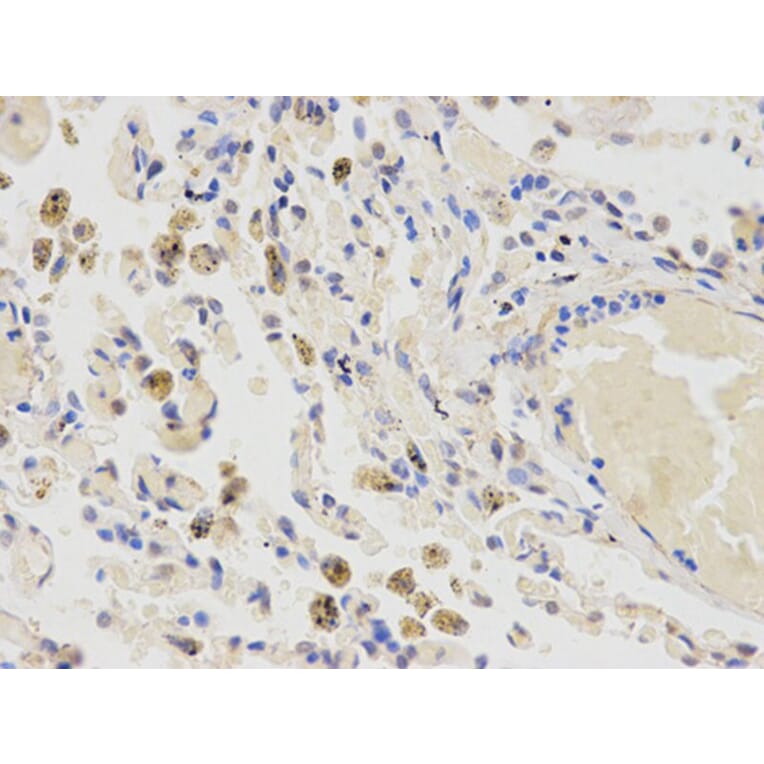 Immunohistochemistry - CYP2E1 Antibody from Signalway Antibody (32630) - Antibodies.com