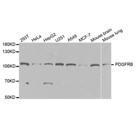 Western blot - PDGFRB Antibody from Signalway Antibody (32646) - Antibodies.com