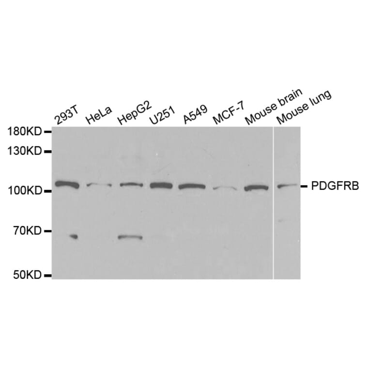Western blot - PDGFRB Antibody from Signalway Antibody (32646) - Antibodies.com