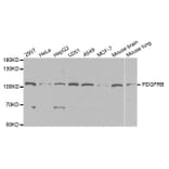 Western blot - PDGFRB Antibody from Signalway Antibody (32646) - Antibodies.com